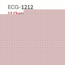 ECG monitoring