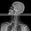 imaging x ray film for machine film x ray film processor wet film