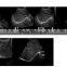 FM-480 Hot Sale 4D Color Doppler for medical