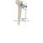 Guaranteed Quality Tibia & Percone External Fixator for Orthopedic External Fixation Surgical Instruments