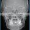 Digital Dental Panoramic Radiology Machine