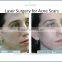 fractional co2 scar removal laser from POP IPL