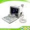 2016 Large Screen LED Good Image Full Digital Portable Ultrasound Scanner Machine with Probe-External Workstation (80 element)