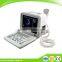 Large Screen Good Image Full Digital Portable Ultrasound Scanner Machine with Probe-External Workstation (80 element)