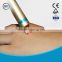 980nm diode laser vascular removal