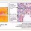 best selling liposonix lipo lipo cavitation equipment elight ipl rf cavitation