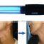 Hand held NB UVB phototherapy 311nm Lamp for Vitiligo Eczema Psoriasis