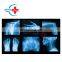 HC-D003 Best type cheap price medical equipment Portable High frequency x-ray machine