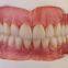 Removable Denture  Dental laboratory in china