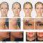 Skin Rejuvenation 2015 Newest HIFU High Intensity Focused Ultrasound/HIFU Machine/HIFU Face Lift Bags Under The Eyes Removal