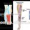 Vascular Removal Laser 980nm Laser Diode 30W Spider Vein Treatment