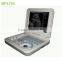 High Quality Laptop Ultrasound Scanner Ultrasound diagnostic devices- BPU16