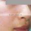 Beauty salon equipments shr hair removal ipl system for sale