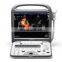 S8 Echocardiography Machine 2D 3D 4D  Echo portable doppler ultrasound scanner/ultrasound machine