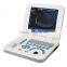 Carejoy Ultrasound Machine portable Ultrasound Scanner with multi frequency probe for hospital clinics community RUS-9000F2