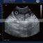MY-A013C 10 years medical supplier laptop b/w ultrasound scan veterinary portable ultrasound machine price