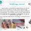 Vascular Removal Diode Laser 980nm anti toe nail fungus laser treatment device spider vein removal machine