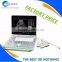 BPU09 Cheapest Laptop Black& White Ultrasound Machine Manufacture Supplies
