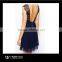 European Style Women Sleeveless Casual Lace Dress