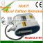 equipment for small business rotary machine for tattoo Q Switch ND Yag Laser tattoo removal
