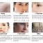 10 in 1 Beauty Salon Facial Care Hydra dermabrasion machine