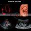 Good quality sonoscape ultrasound machine color trolley ultrasound machine/sonoscape ultrasound machine/sonoscape p20