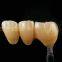 Dental crown zirconia Cercon,dental teeth,dental prosthesis laboratoire dentaire, Dentallabor, laboratorio dental, dental laboratory, Shenzhen LJ dental lab
