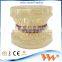 Popular Transparent Plastic Pathologic Dental Implant Model for study