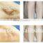 New products bikini line hair removal machine 808nm diode laser hair removal