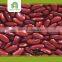 import export business opportunity red kidney beans import