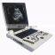 High quality full digital black and white ultrasound diagnostic system for examination