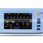 AJ-3000Palm Cheap Patient Monitor