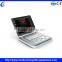 Ultrasound Machines 3d 4d
