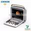 medical Chison portable 4d color ultrasound Chison q9