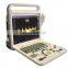 medical ultrasound instrument laptop color doppler portable ultrasound color doppler machine