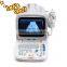 Portable PC platform 3D Ultrasound Scanner diagnosis of Abdomen Cardiac Gynecology Obstetrics Thyroid Gland Small Organs Urology
