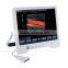 cardiac ultrasound machine and echo color doppler system