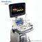 Color ultrasound scanner sonoscape veterinary ultrasound