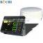 Boat 12 inches Radar Target Tracking System
