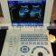 Laptop Ultrasound Scanner & Ultrasound Scanner For Horse