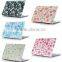 little flower Frosted Plastic Case for Macbook Pro Retina 13