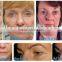 13mm wrinkle and double chine removal hifi body slimming