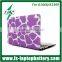 Rubberized Hard Case for Macbook Pro 13/15 Retina Air 13/11" Inch+Keyboard Cover