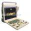 Good quality 15 inch LED full digital  Portable  color doppler ultrasound scanner