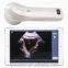 Wireless Mini Ultrasound Probe (4D Bladder Scanner)