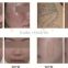 1064 nm 532nm q switch nd yag laser skin whitening beauty machine tattoo removal medical eqiupment 2016