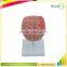 Organs Human Body Anatomy Brain Model Of Stroke