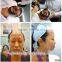 factory direct nd yag laser/high uqality nd yag laser/nd yag laser tattoo removal permanent make up