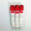 red tup vacuum pro-agulation tube with clot activator