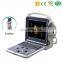 High Resolution MY-A035B medical Portable Full Digital Color Doppler Ultrasound Diagnostic System with Ultrasound probe